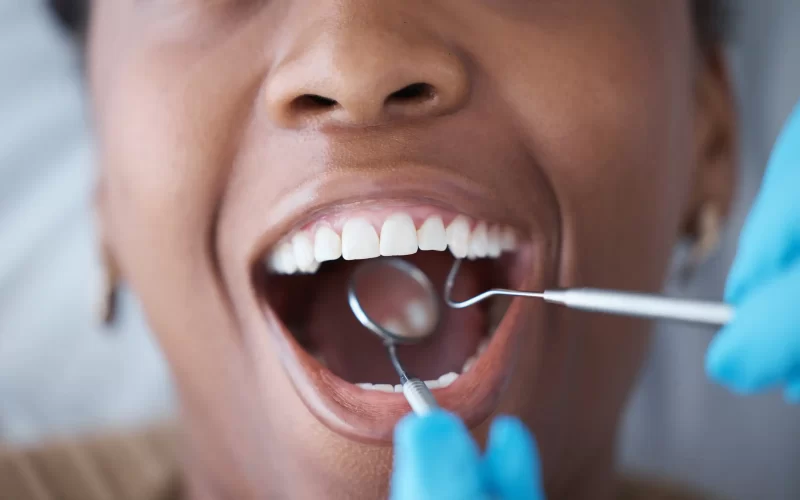 An image of person getting their teeth looked at